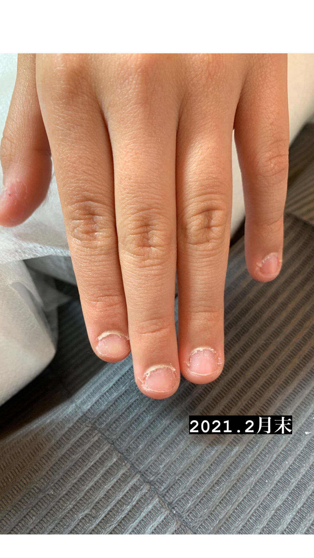 ミダシナミネイル/Kメディカルニーズ/ネイルオイル・トリートメントを使ったクチコミ（3枚目）