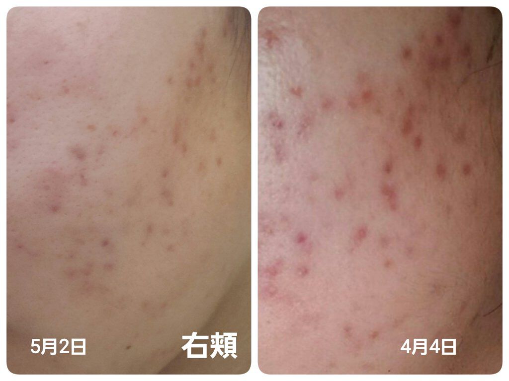 を使ったクチコミ（1枚目）