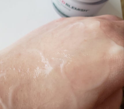 るな on LIPS 「Dr.G(ドクタージー)様から提供レッドブレミッシュクリアスー..」(4枚目)