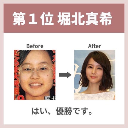 あなたの肌に合ったスキンケア💐コーくん先生 on LIPS 「垢抜けすぎwww『よかった!!』『超タメになった!』と思ったら..」(8枚目)