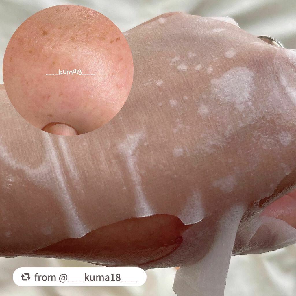 ブラックティー ユース セラム/innisfree/美容液を使ったクチコミ(4枚目)