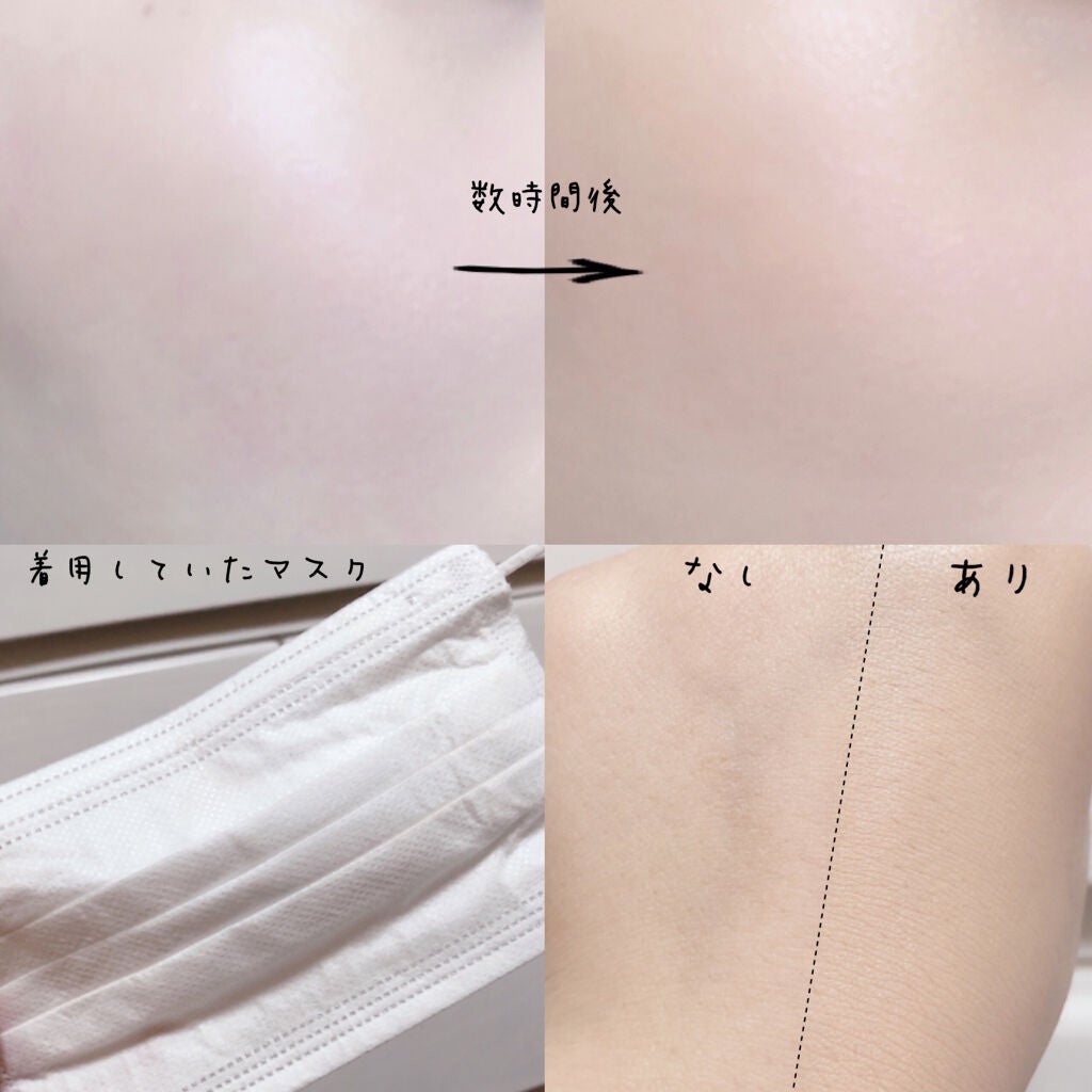 ピンクティーツリーカバークッション/APLIN/クッションファンデーションを使ったクチコミ(2枚目)