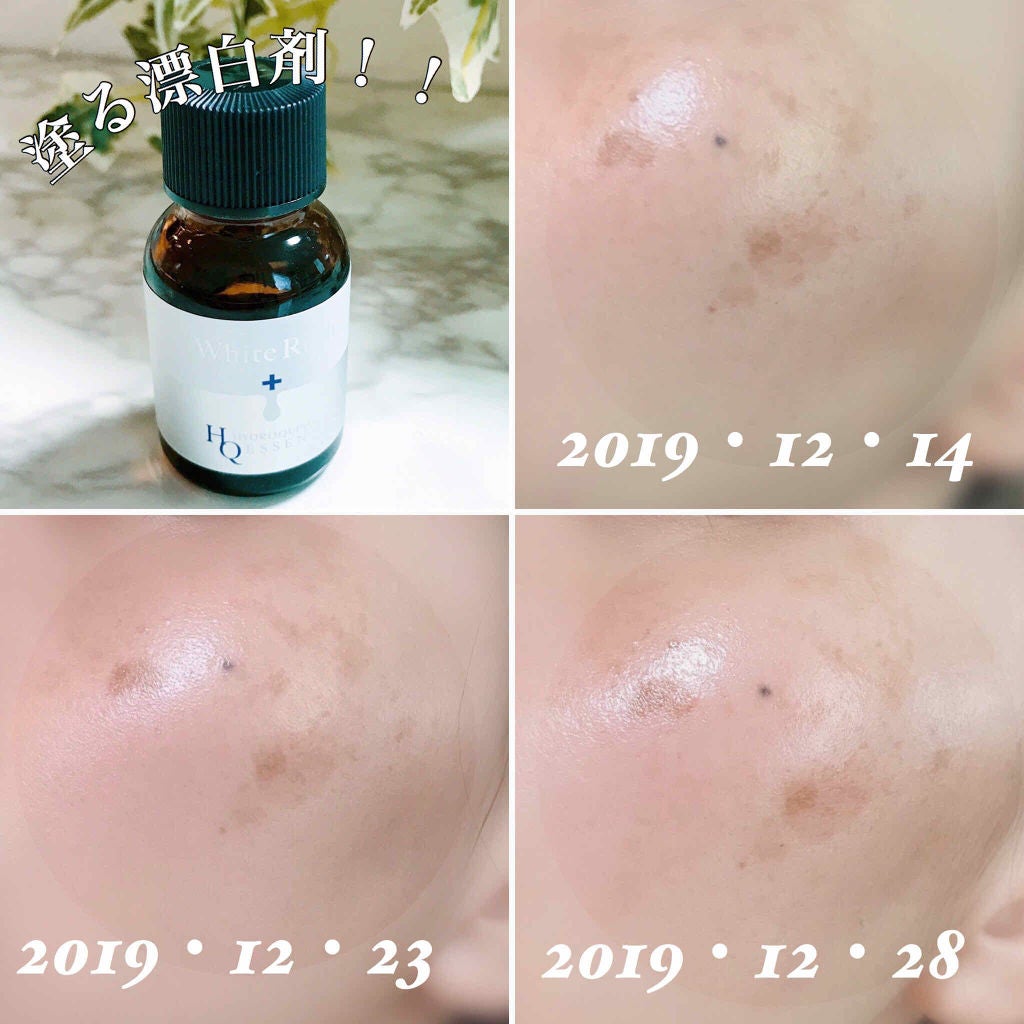 ホワイトラッシュ HQ美容液/White Rush/美容液を使ったクチコミ(4枚目)