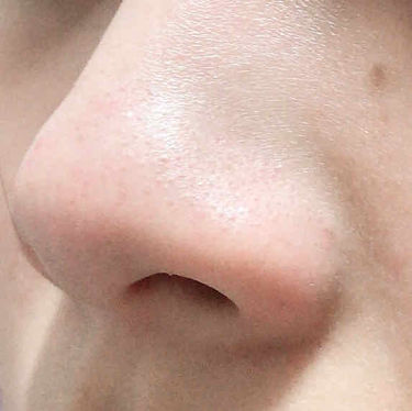 ホホバオイル 無印良品の使い方を徹底解説 鼻の黒ずみ 毛穴 ニキビに悩んでる方必見 By Yuun 普通肌 代前半 Lips
