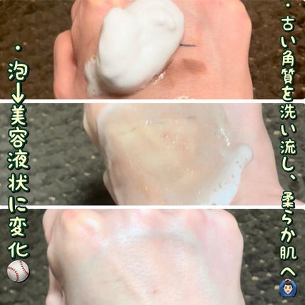 炭酸クレンジング/肌ナチュール/泡洗顔を使ったクチコミ(3枚目)