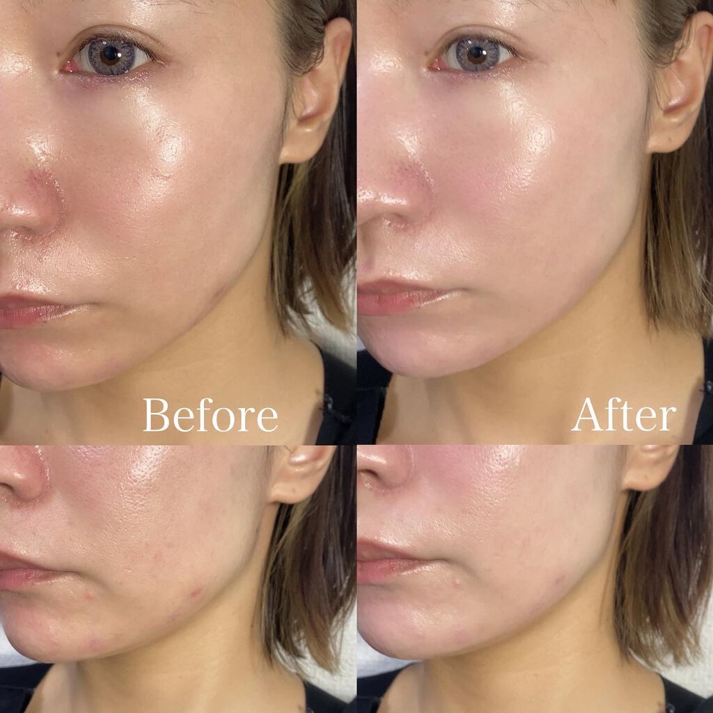 CICA デイリースージングマスク/VT/シートマスク・パックを使ったクチコミ(5枚目)