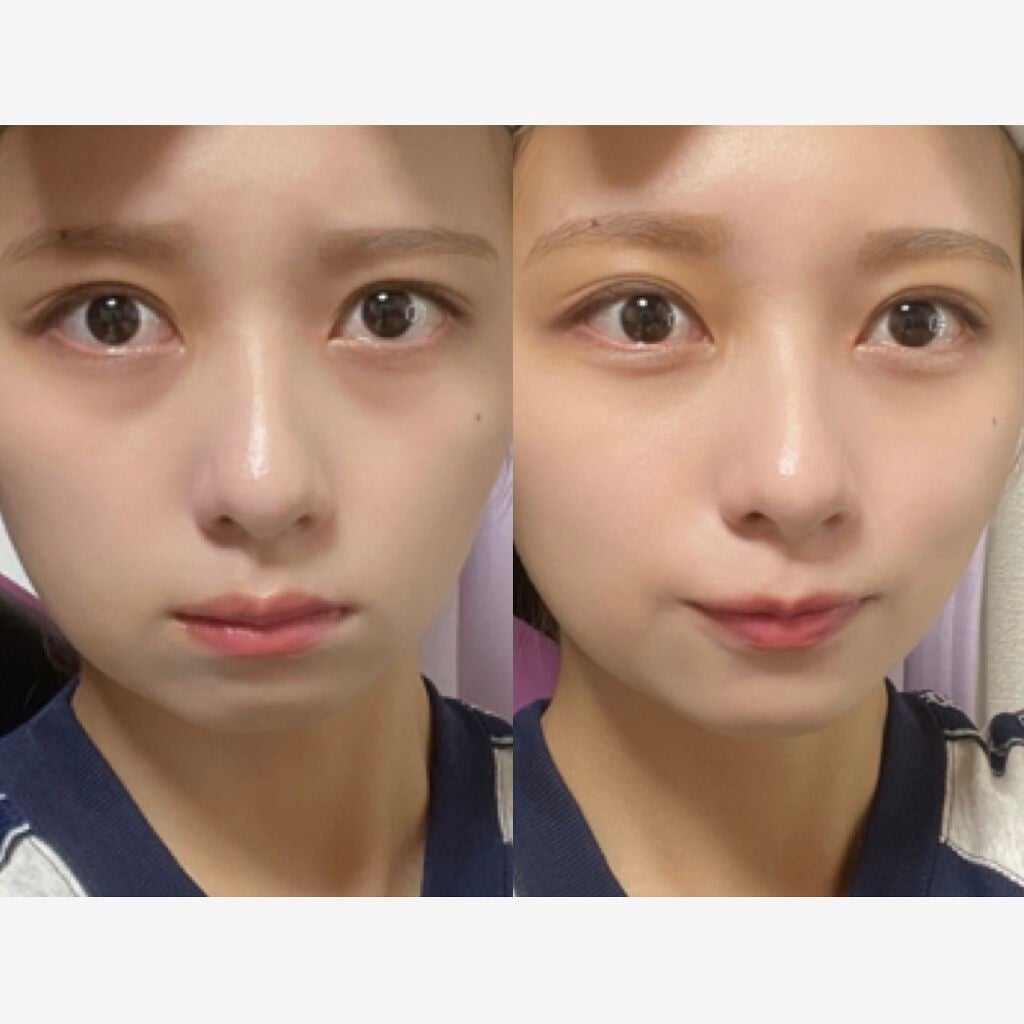 ラディアント タッチ/YVES SAINT LAURENT BEAUTE/リキッドコンシーラーを使ったクチコミ(1枚目)