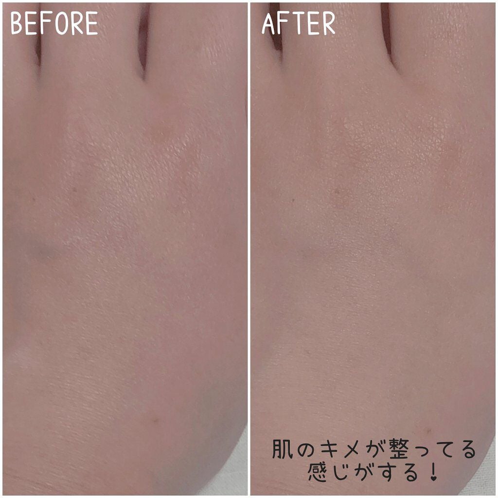 ハトムギ化粧水(ナチュリエ スキンコンディショナー R )/ナチュリエ/化粧水を使ったクチコミ(2枚目)