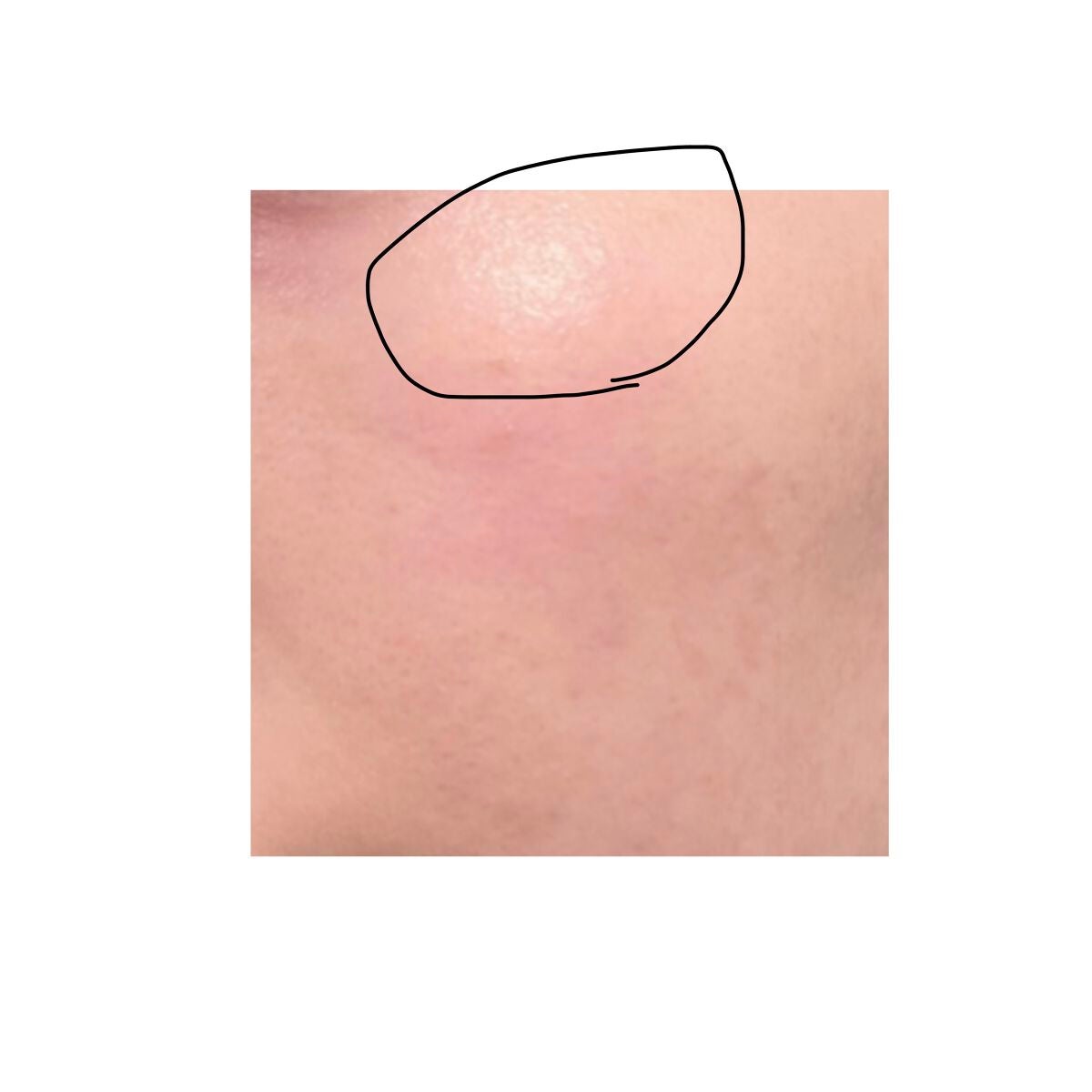 RXザ・レチノール0.1クリーム/COSRX/フェイスクリームを使ったクチコミ(2枚目)