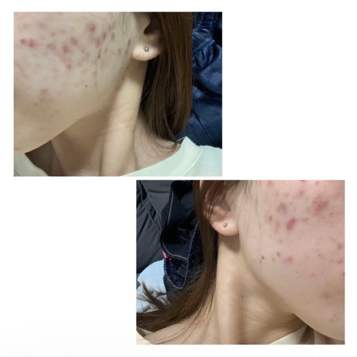 リアルカロテンブレミッシュクリアセラム/APRILSKIN/美容液を使ったクチコミ(2枚目)