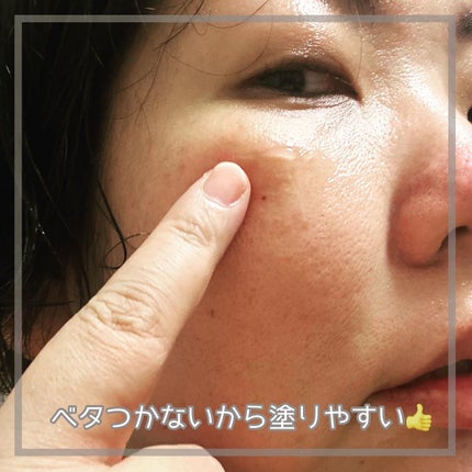 FEG アゼライン酸 15%配合 クリアスキンクリームA /FEG/フェイスクリームを使ったクチコミ(3枚目)