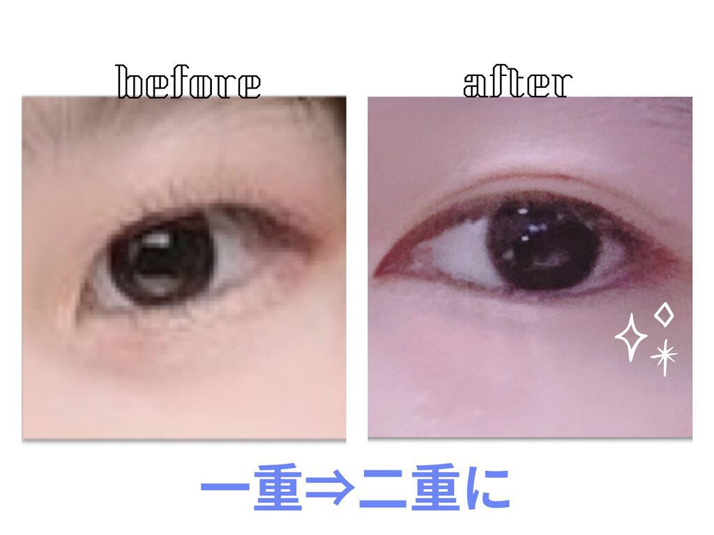 TWOOL ダブルアイリッドグルー/SHOBIDO/二重まぶた用アイテムを使ったクチコミ（1枚目）