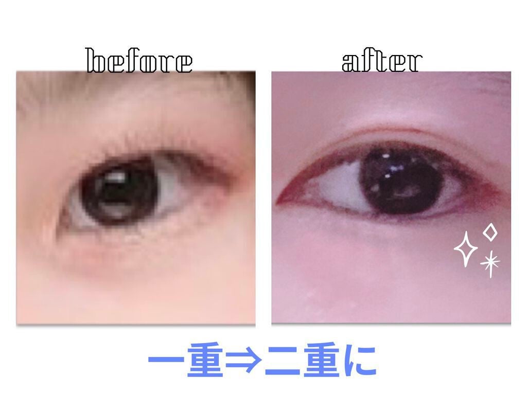 TWOOL ダブルアイリッドグルー/SHOBIDO/二重まぶた用アイテムを使ったクチコミ(1枚目)