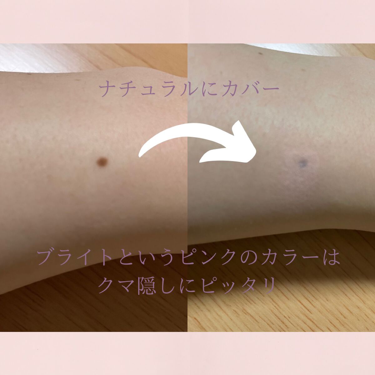 ロングラスティングチップコンシーラー/LUNA/リキッドコンシーラーを使ったクチコミ（2枚目）