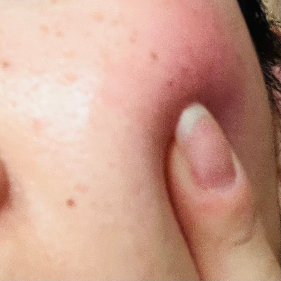 PDRNヒアルロン酸カプセル100セラム/Anua/美容液を使ったクチコミ(4枚目)