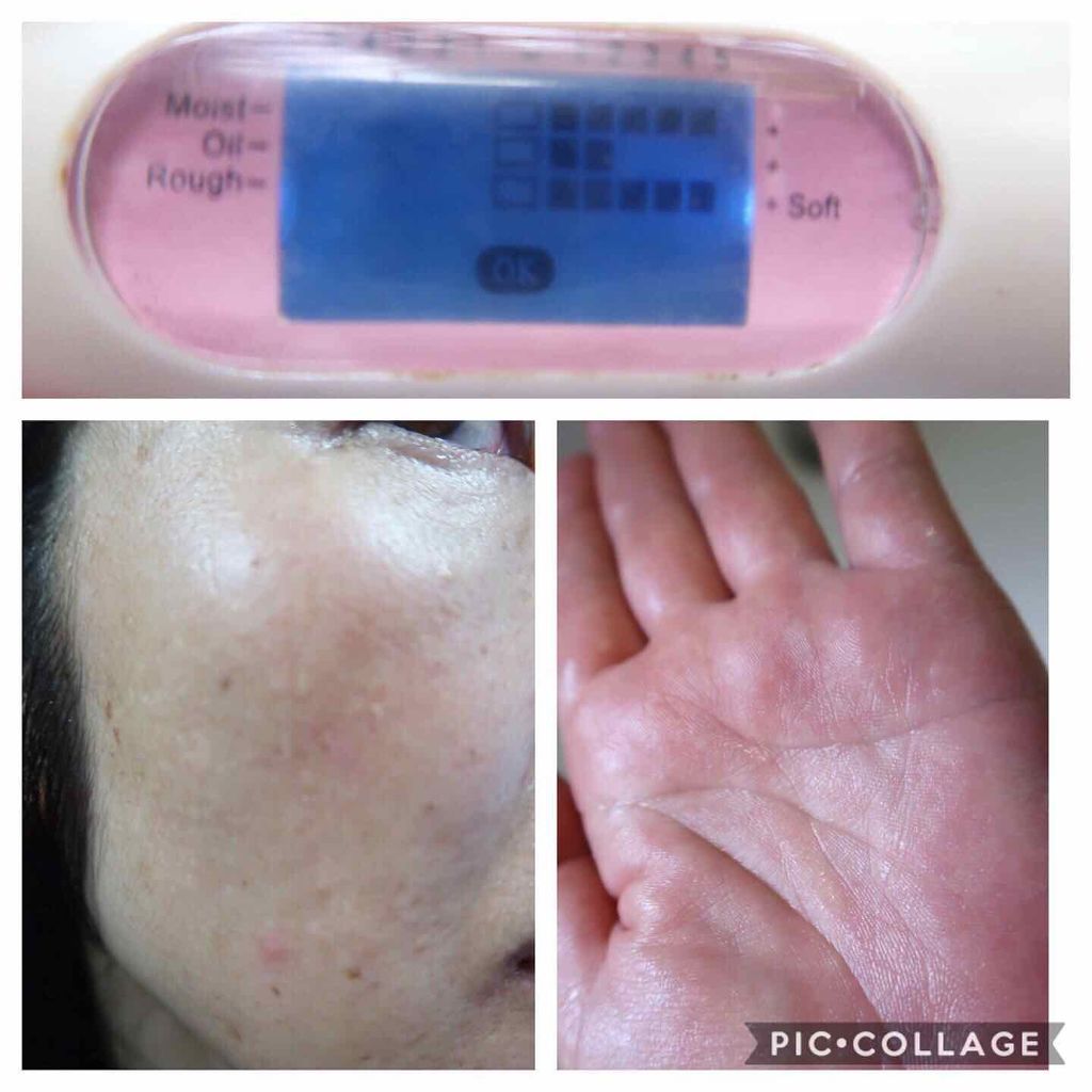 ミスクレオ on LIPS 「こちらブースターとしても使えて肌のターンオーバーも整えてくれる..」(4枚目)