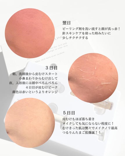 まゆ on LIPS 「#pr@gangnam_doll\BQCELL/ビーキューセル..」(4枚目)