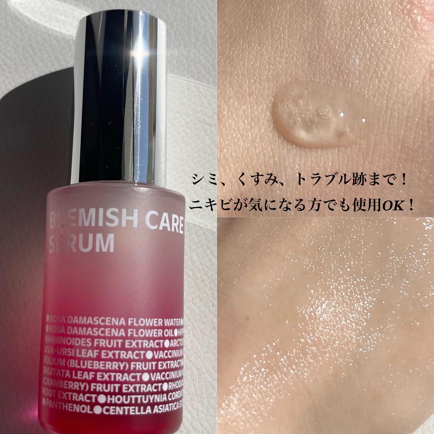 ブレミッシュケアマスク/ISOI/シートマスク・パックを使ったクチコミ（2枚目）