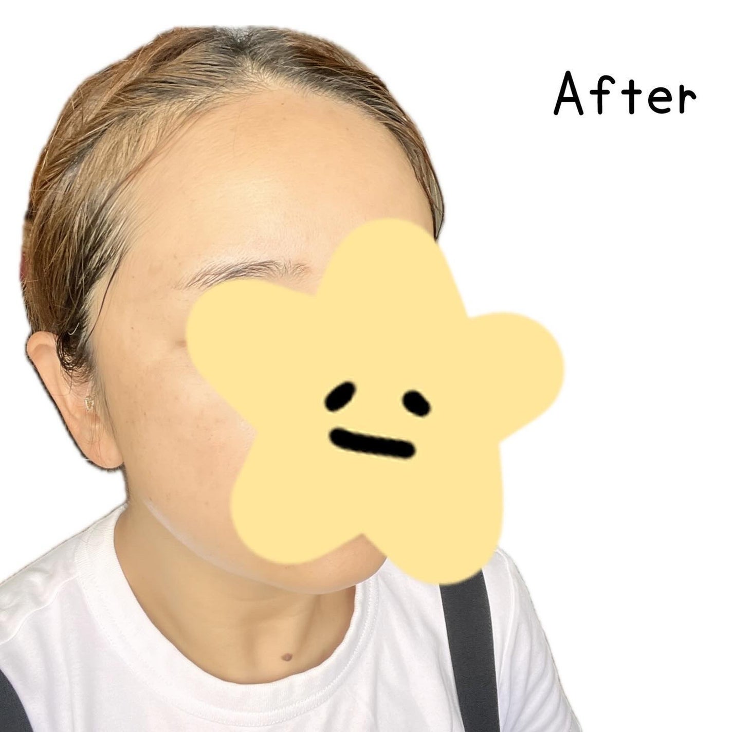 ABC-Gピールウォッシュ/ドクターケイ/泡洗顔を使ったクチコミ(3枚目)