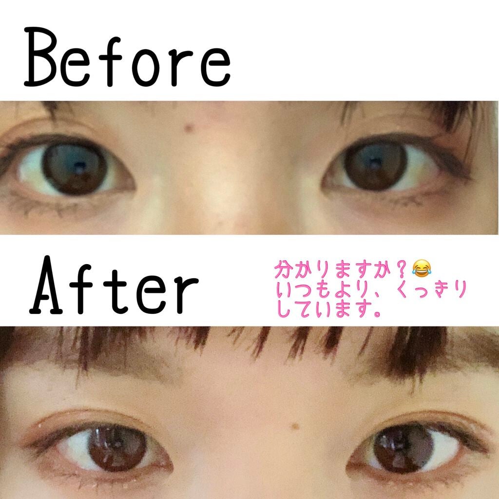 オリシキ アイリッドスキンフィルム /D-UP/二重まぶた用アイテムを使ったクチコミ(2枚目)