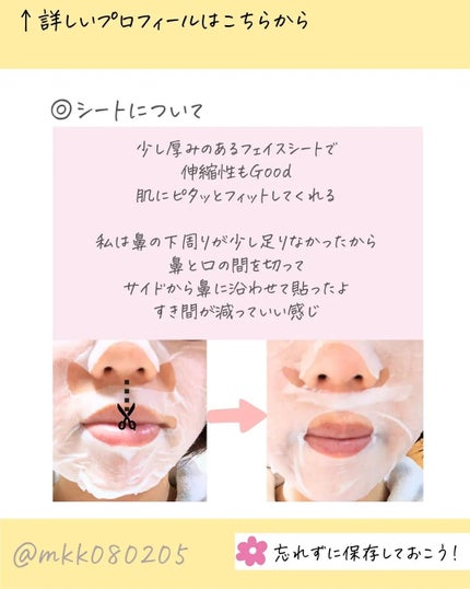 ルルルンピュア エブリーズ/ルルルン/シートマスク・パックを使ったクチコミ(5枚目)