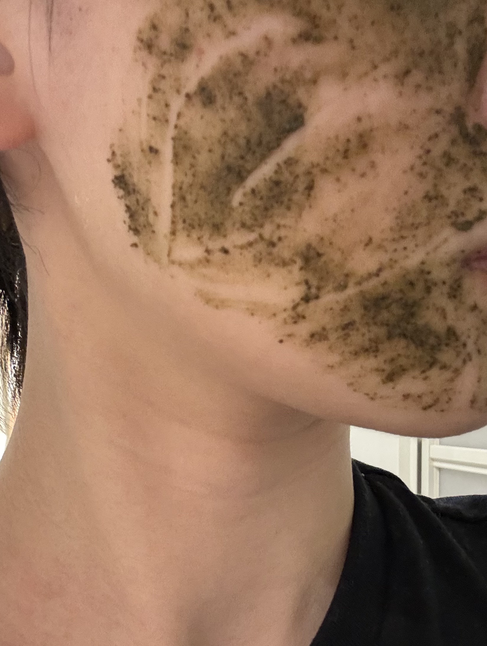 ティーツリーハーブピーリングパック/WellDerma/洗い流すパック・マスクを使ったクチコミ（3枚目）