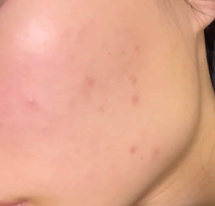 シカペプタリペアセラム/Neulii/美容液を使ったクチコミ(3枚目)