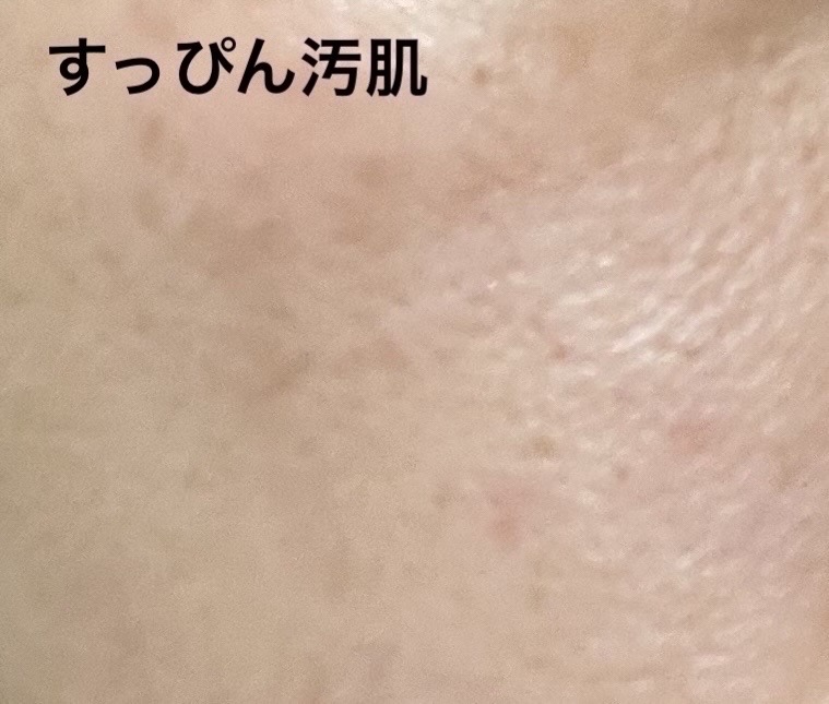 シルキールースモイストパウダー/キャンメイク/ルースパウダーを使ったクチコミ（3枚目）