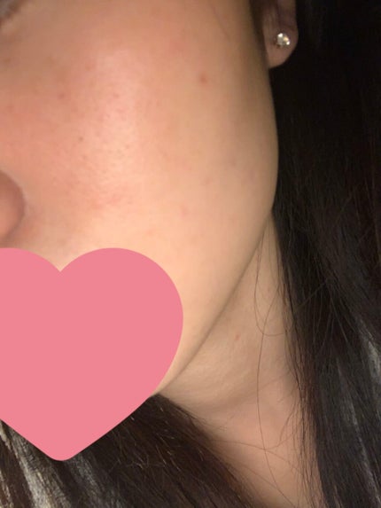 保湿浸透水バランシング/肌をうるおす保湿スキンケア/化粧水を使ったクチコミ(1枚目)