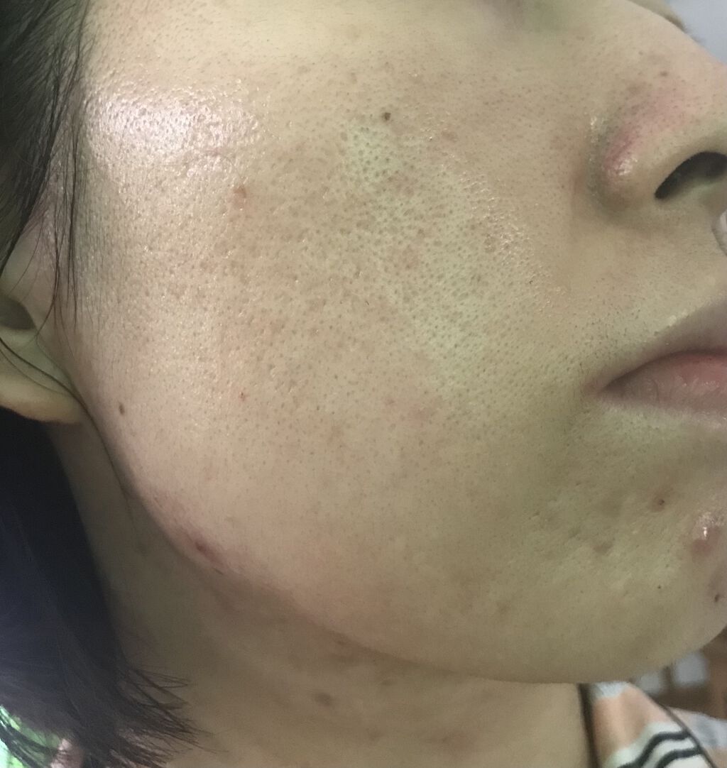 SCINIC The Simple Daily Lotion/SCINIC/乳液を使ったクチコミ（2枚目）