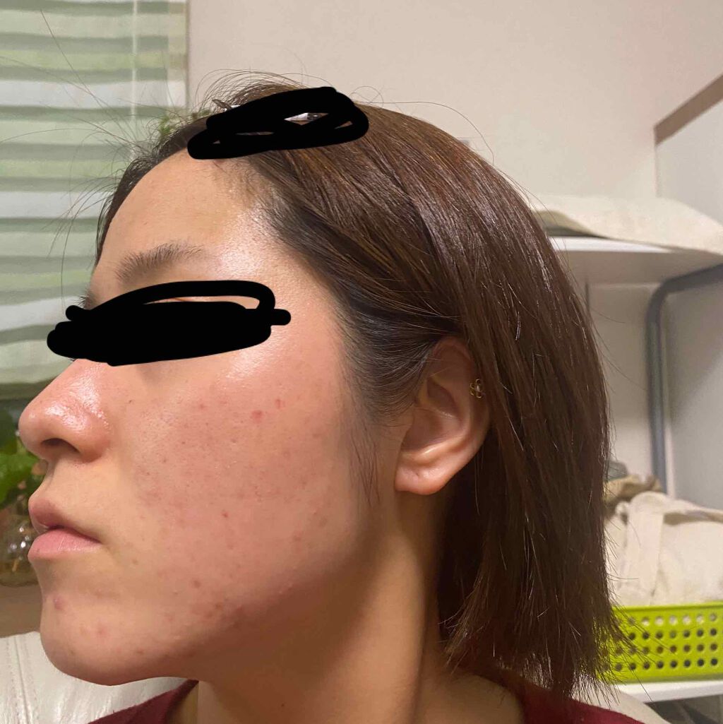 ルルルンプレシャス RED(モイスト)【旧】/ルルルン/シートマスク・パックを使ったクチコミ(3枚目)