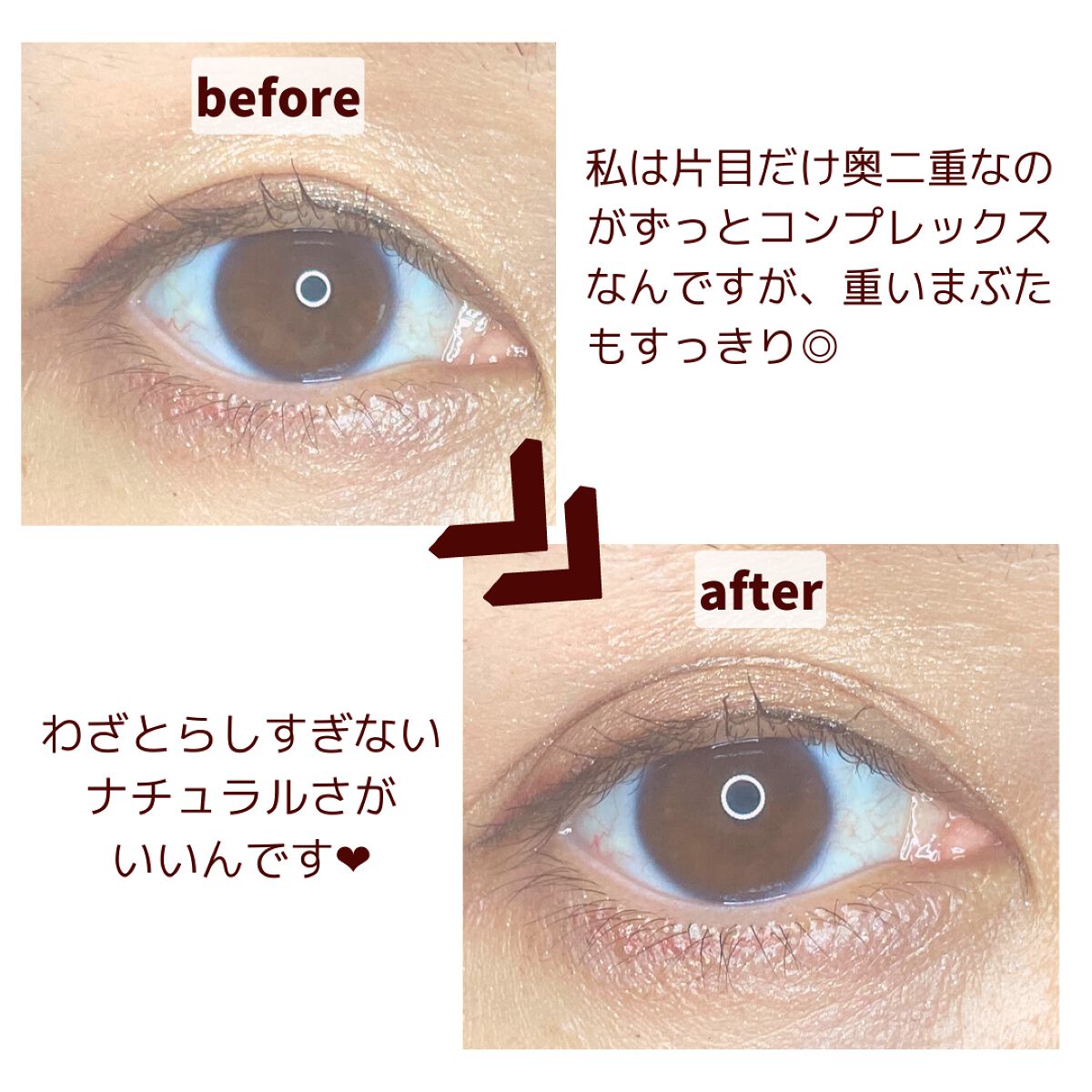 タフグルーX/フィクシー/二重まぶた用アイテムを使ったクチコミ（1枚目）