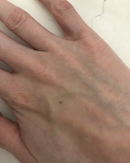 スポッツコンシーラー/インテグレート/リキッドコンシーラーを使ったクチコミ(4枚目)