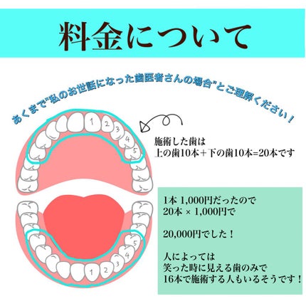 さくま on LIPS 「さくまと申します☻2回目のオフィスホワイトニングに行ってきたの..」(2枚目)