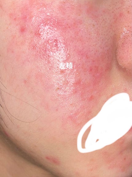 を使ったクチコミ(2枚目)