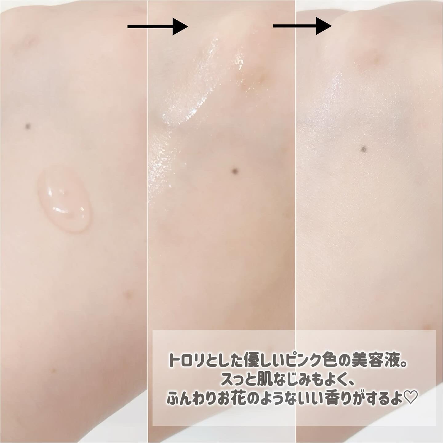 桃70%ナイアシンセラム/Anua/美容液を使ったクチコミ（3枚目）