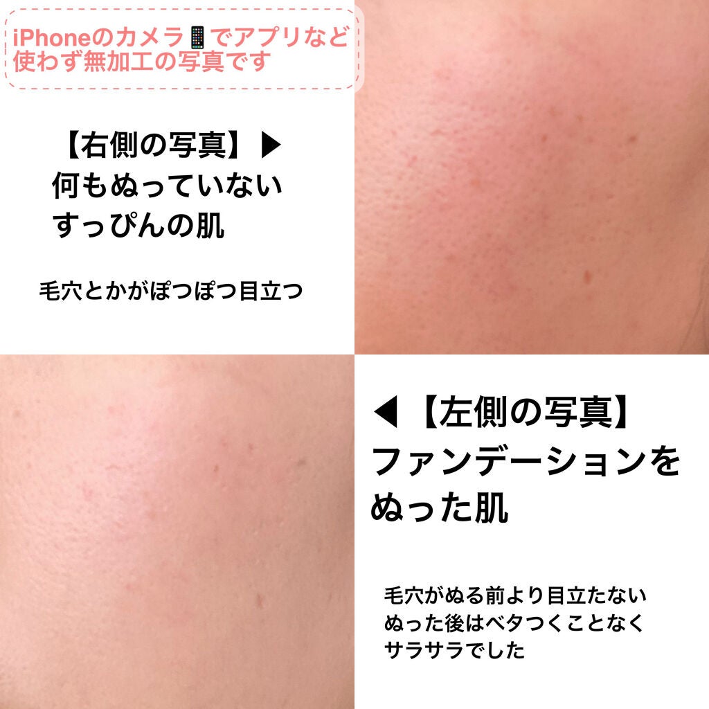 リアルカバーリキッド(ライトグロウ)/KATE/リキッドファンデーションを使ったクチコミ(3枚目)