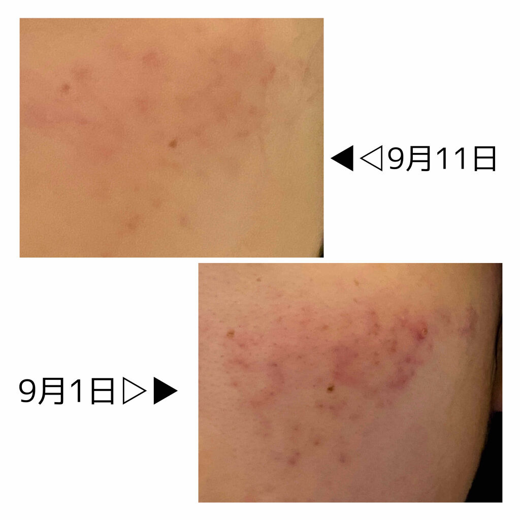 ハトムギ保湿ジェル(ナチュリエ スキンコンディショニングジェル)/ナチュリエ/美容液を使ったクチコミ（2枚目）