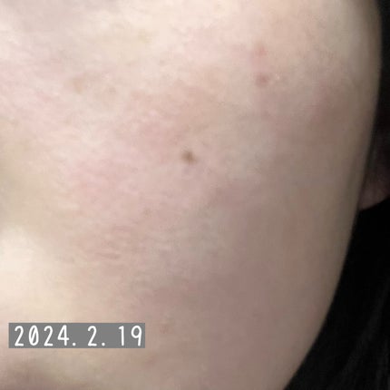 ブライトニングクリア ローション MB 本体/d プログラム/化粧水を使ったクチコミ(3枚目)