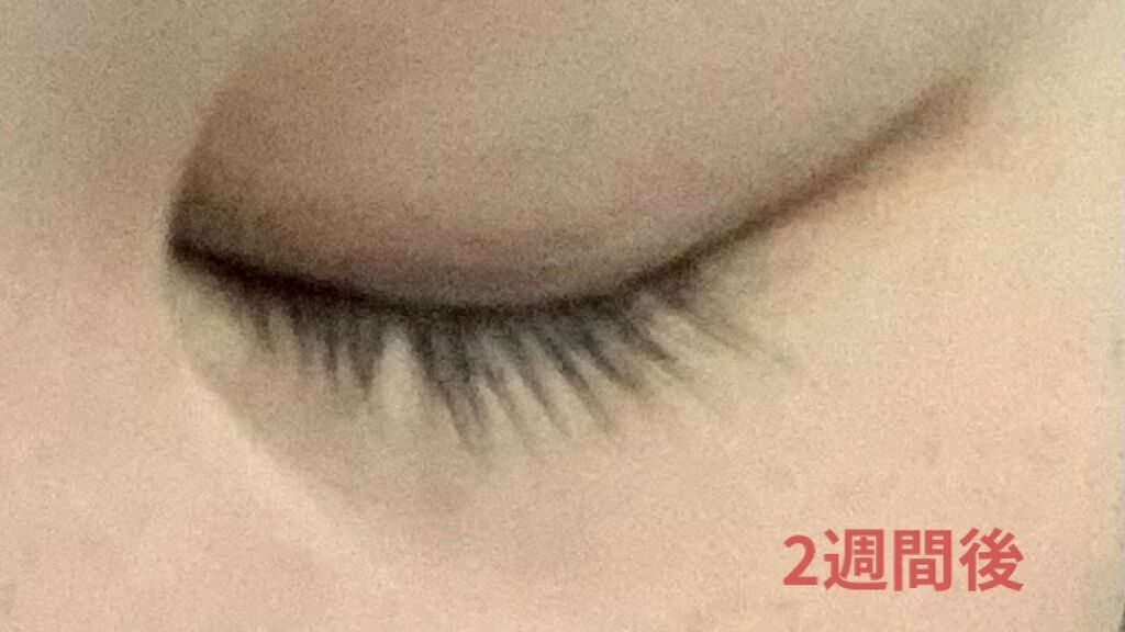 スカルプD ボーテ ピュアフリーアイラッシュセラム/アンファー(スカルプD)/まつげ美容液を使ったクチコミ（2枚目）