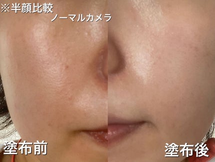 UVã€ã㢠XL ãããã¯ã·ã§ã³ããŒã³ã¢ãã ããŒãº/ã© ããã·ã¥ ããŒ/æ¥çŒãæ¢ãã¯ãªãŒã ã䜿ã£ãã¯ãã³ãïŒ4æç®ïŒ