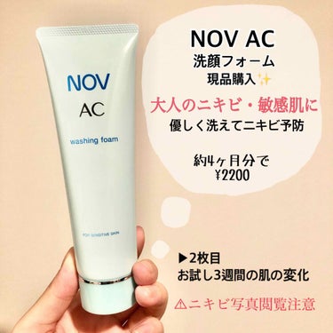 ●NOV AC 洗顔フォーム　90g  ¥2200

以前購入したお試しセットに入っていたこちらの洗顔フォームがとても良かったので、ついに現品を購入しました！

お試しセットを使った1日目と最終日、3週