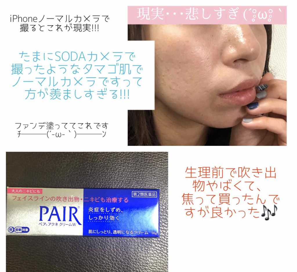 ペアアクネクリームW(医薬品)/ペア/その他を使ったクチコミ(2枚目)