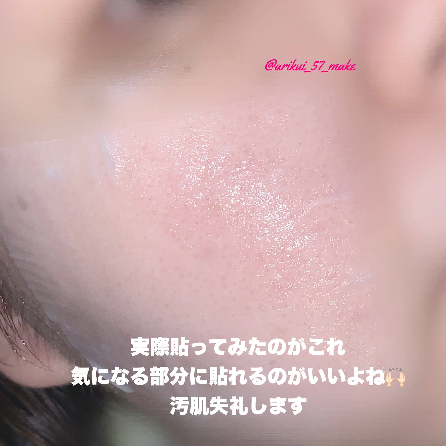 リズム べース ポイント集中パック(シャイン)/RISM/シートマスク・パックを使ったクチコミ(4枚目)