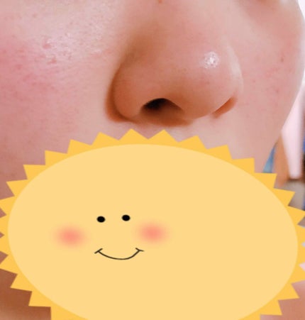 フローズン タッチ トーニング ローション/雪肌精/化粧水を使ったクチコミ(2枚目)