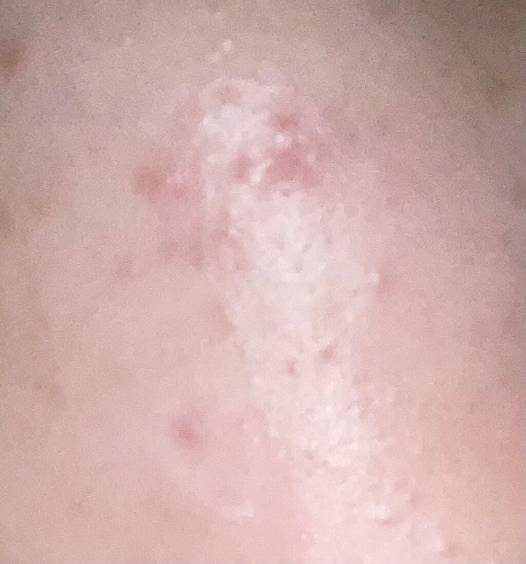 DHC はとむぎエキス/DHC/健康サプリメントを使ったクチコミ(2枚目)