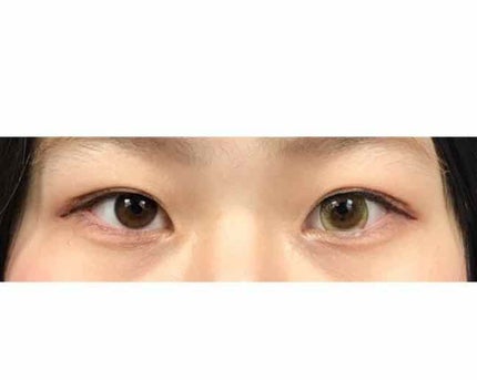 eye closet 1day SweetSeries "Girly"(アイクローゼットワンデースウィートシリーズ ガーリー)/EYE CLOSET/ワンデー(1DAY)カラコンを使ったクチコミ(2枚目)