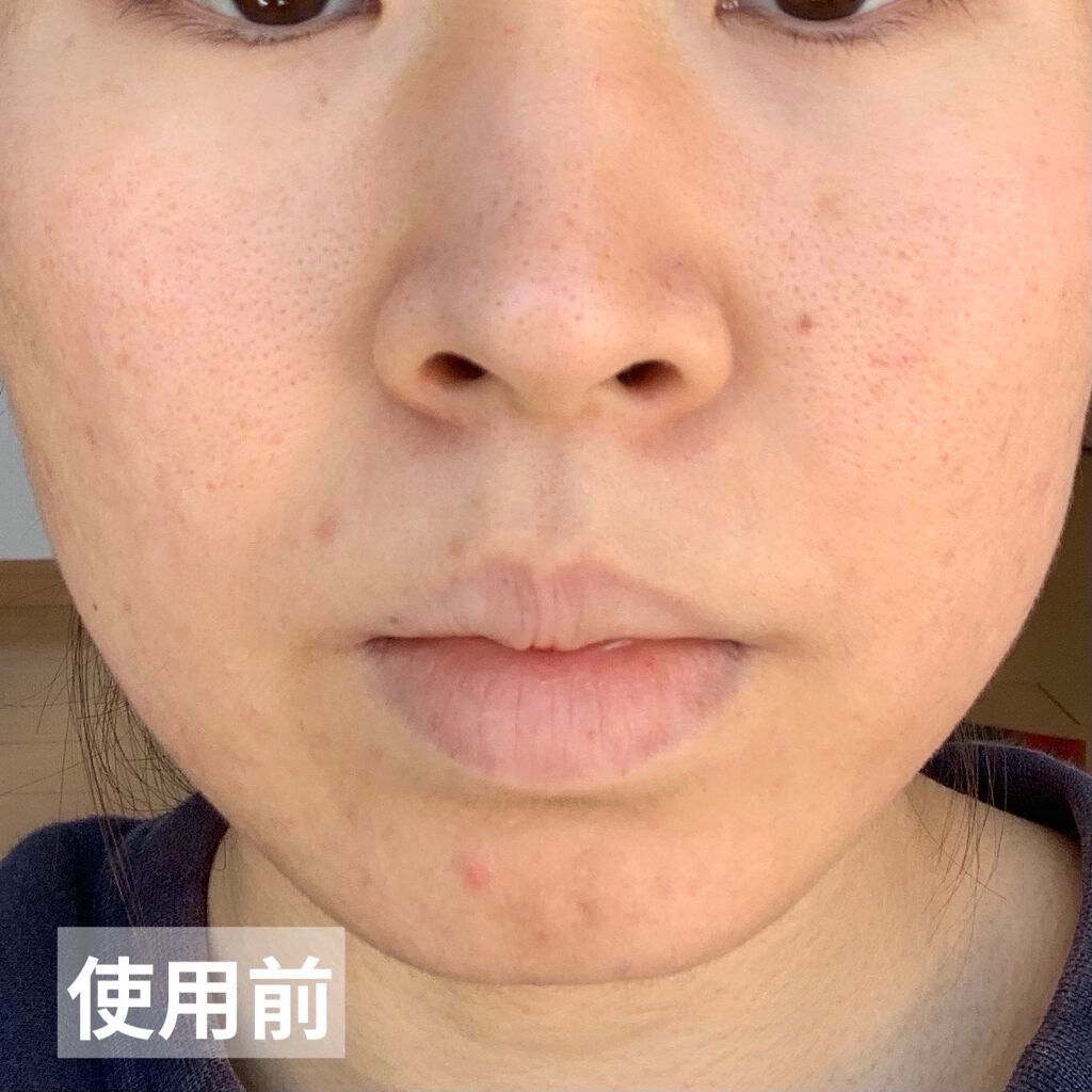 ハトムギ化粧水(ナチュリエ スキンコンディショナー R )/ナチュリエ/化粧水を使ったクチコミ(5枚目)