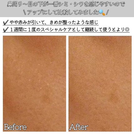薬用リンクルフェイスマスク/akaran+/シートマスク・パックを使ったクチコミ(3枚目)