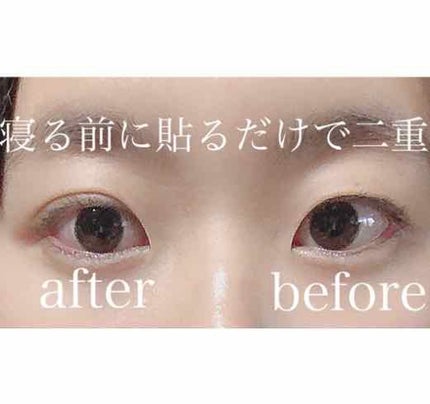 アイテープ(絆創膏タイプ、レギュラー、70枚)/DAISO/二重まぶた用アイテムを使ったクチコミ(1枚目)